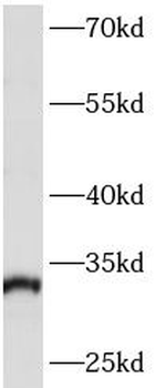 ARPC2 Antibody