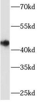 ARSB Antibody