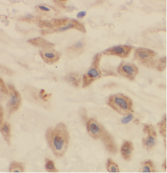 ARSB Antibody