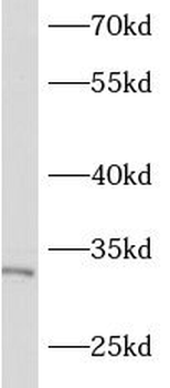 ASB17 Rabbit Polyclonal Antibody
