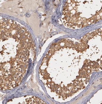 ASB17 Rabbit Polyclonal Antibody