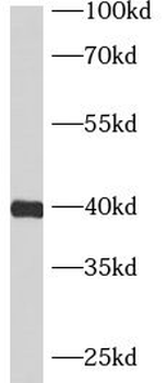 ASB5 Rabbit Polyclonal Antibody