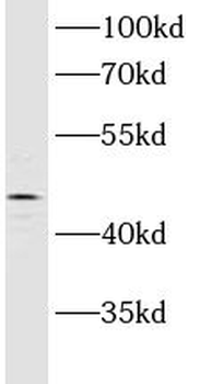 ASCC1 Antibody