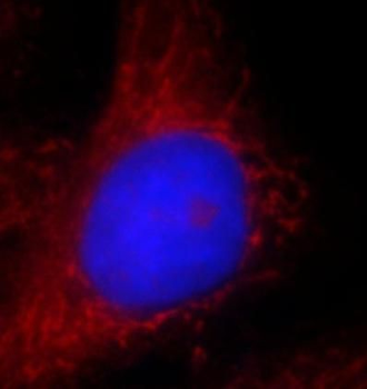 ASCC2 Rabbit Polyclonal Antibody