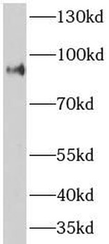 ASCC2 Rabbit Polyclonal Antibody