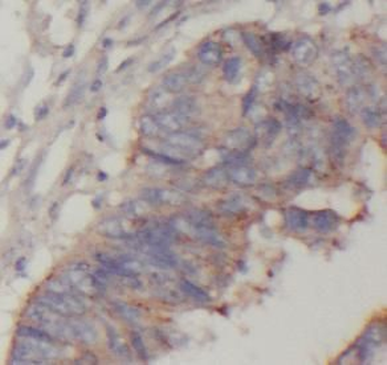 ASCC2 Rabbit Polyclonal Antibody