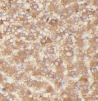 ASGR1 Antibody