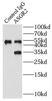 ASGR2 Antibody