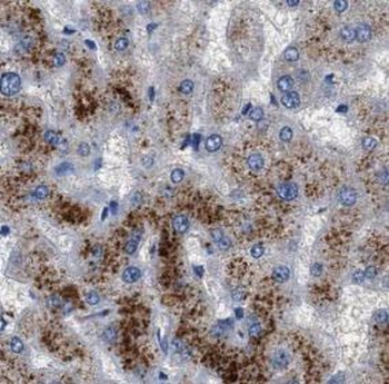 ASGR2 Antibody