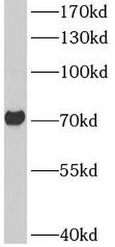 ASIC2 Rabbit Polyclonal Antibody