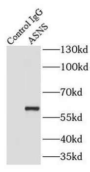 ASNS Rabbit Polyclonal Antibody