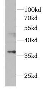ASPA Rabbit Polyclonal Antibody