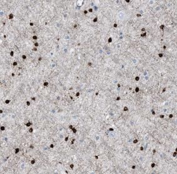 ASPA Rabbit Polyclonal Antibody