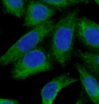 ASS1 Rabbit Polyclonal Antibody