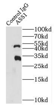 ASS1 Rabbit Polyclonal Antibody