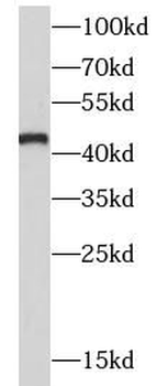 ASS1 Rabbit Polyclonal Antibody