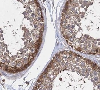 ASS1 Rabbit Polyclonal Antibody