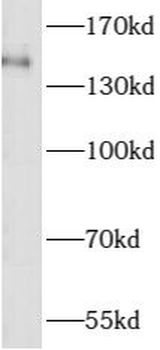 ASTN2 Rabbit Polyclonal Antibody