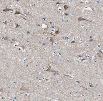 ASTN2 Rabbit Polyclonal Antibody
