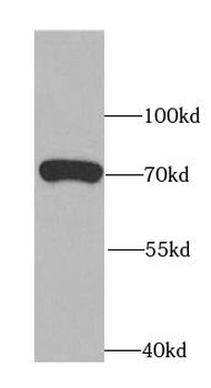 ATG13 Rabbit Polyclonal Antibody