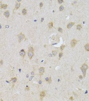 ATG13 Rabbit Polyclonal Antibody