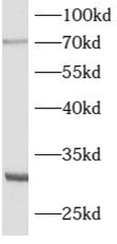 ATG16L2 Antibody