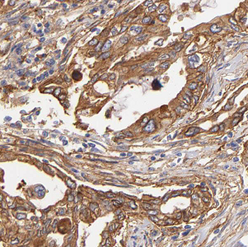 ATG4B Rabbit Polyclonal Antibody