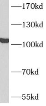 ATN1 Rabbit Polyclonal Antibody