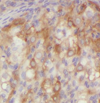 ATN1 Rabbit Polyclonal Antibody