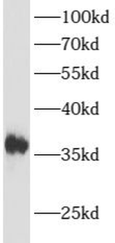 ATOH1 Rabbit Polyclonal Antibody