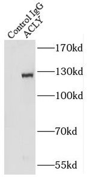 ACLY Rabbit Polyclonal Antibody