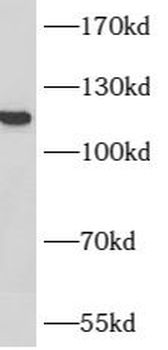 ACLY Rabbit Polyclonal Antibody