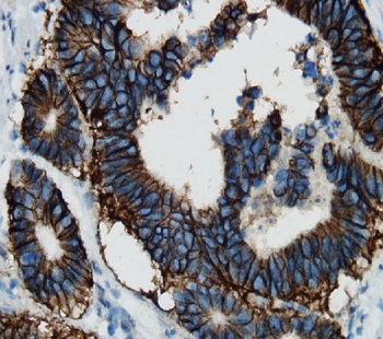 ATP1A1 Rabbit Polyclonal Antibody