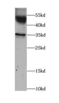 ATP1B1 Antibody