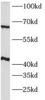 ATP1B2 Rabbit Polyclonal Antibody