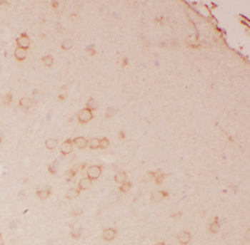 ATP1B2 Rabbit Polyclonal Antibody