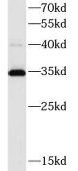 ATP5F1C Rabbit Polyclonal Antibody