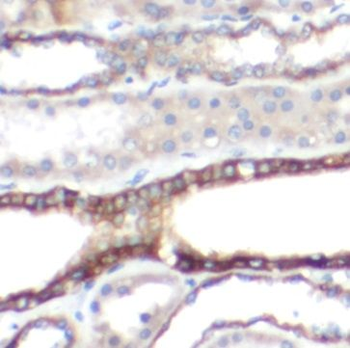 ATP5F1C Rabbit Polyclonal Antibody