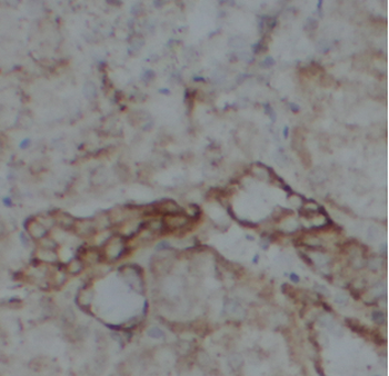 ATP5F1D Rabbit Polyclonal Antibody