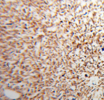 ATP5PF Rabbit Polyclonal Antibody