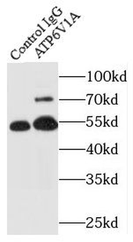 ATP6V1A Antibody