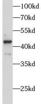 ATP6V1C1 Rabbit Polyclonal Antibody