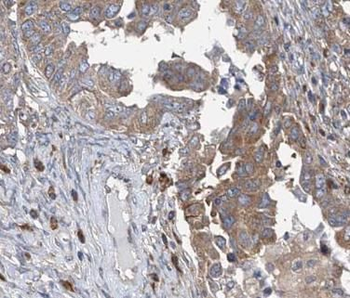 ATP6V1C1 Rabbit Polyclonal Antibody