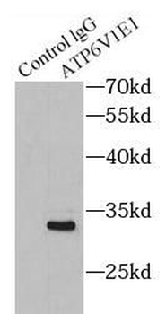 ATP6V1E1 Rabbit Polyclonal Antibody
