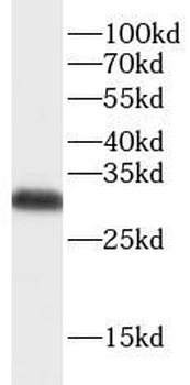 ATP6V1E1 Rabbit Polyclonal Antibody