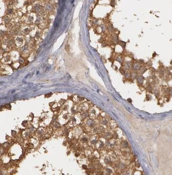 ATP6V1E1 Rabbit Polyclonal Antibody