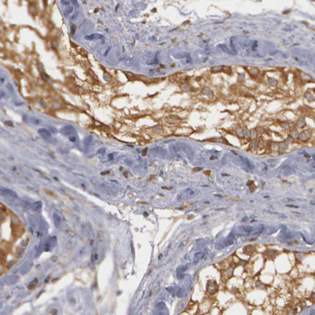 ATP6V1F Rabbit Polyclonal Antibody