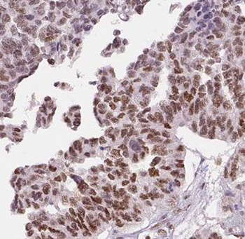 ATXN10 Rabbit Polyclonal Antibody