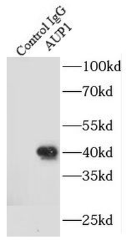 AUP1 Rabbit Polyclonal Antibody