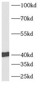 AUP1 Rabbit Polyclonal Antibody